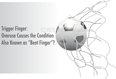 Trigger Finger: What Causes the Condition Also Known as “Bent Finger”?